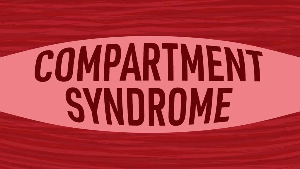Compartment Syndrome The 5 Ps Ausmed