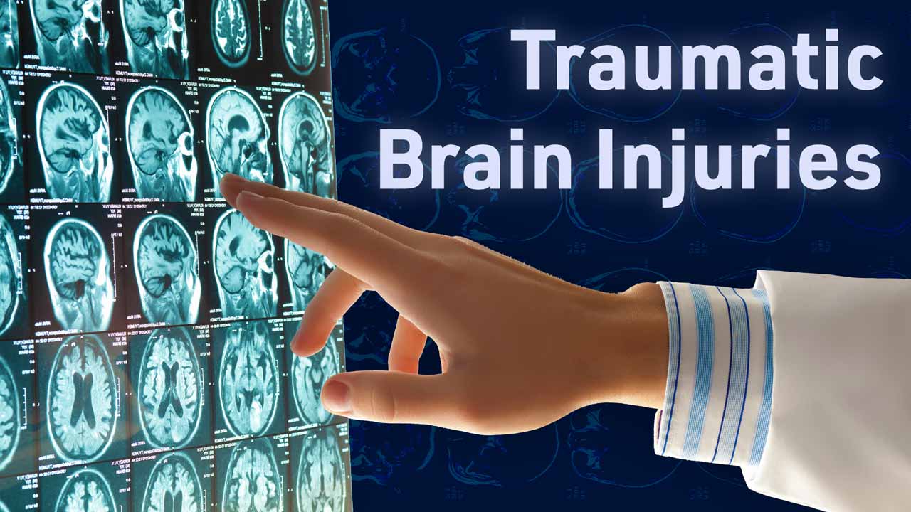 Image for Traumatic Brain Injuries