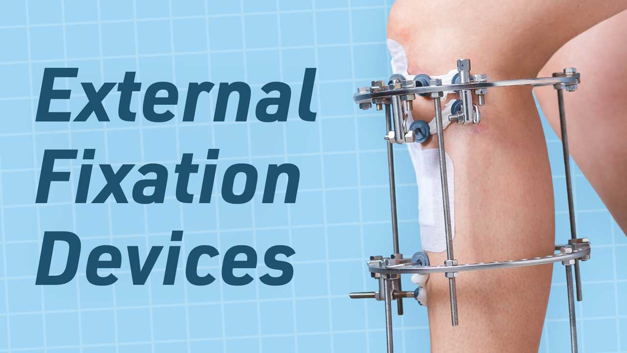 The Care of External Fixation Devices