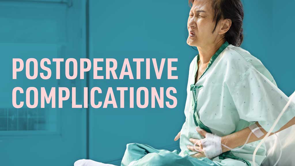Image for Postoperative Complications: Clinical Guidelines for Nurses