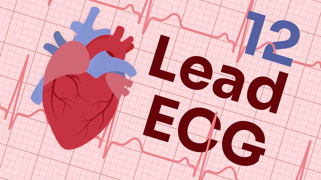 Image for 12 Lead ECG Placement