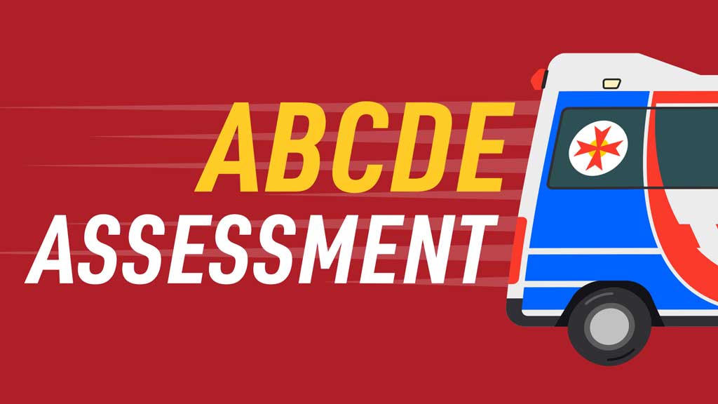 Image for How To Assess a Deteriorating / Critically Ill Patient (ABCDE Assessment)