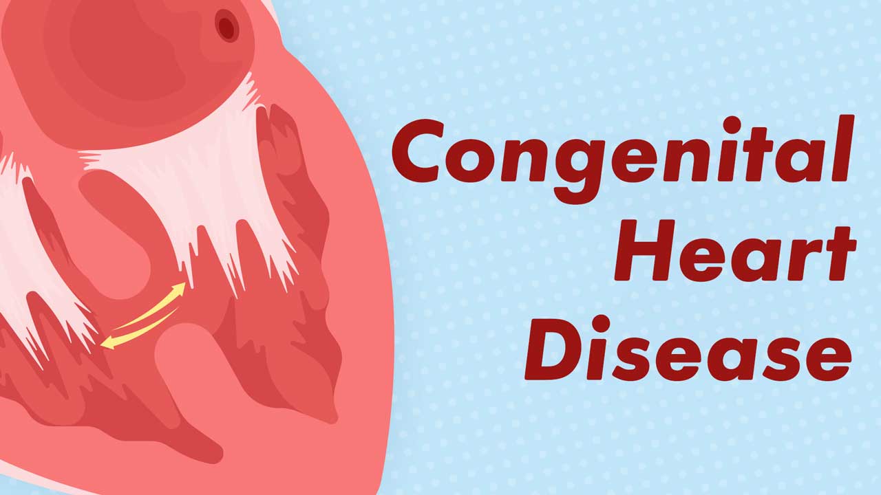 Image for Understanding Congenital Heart Disease
