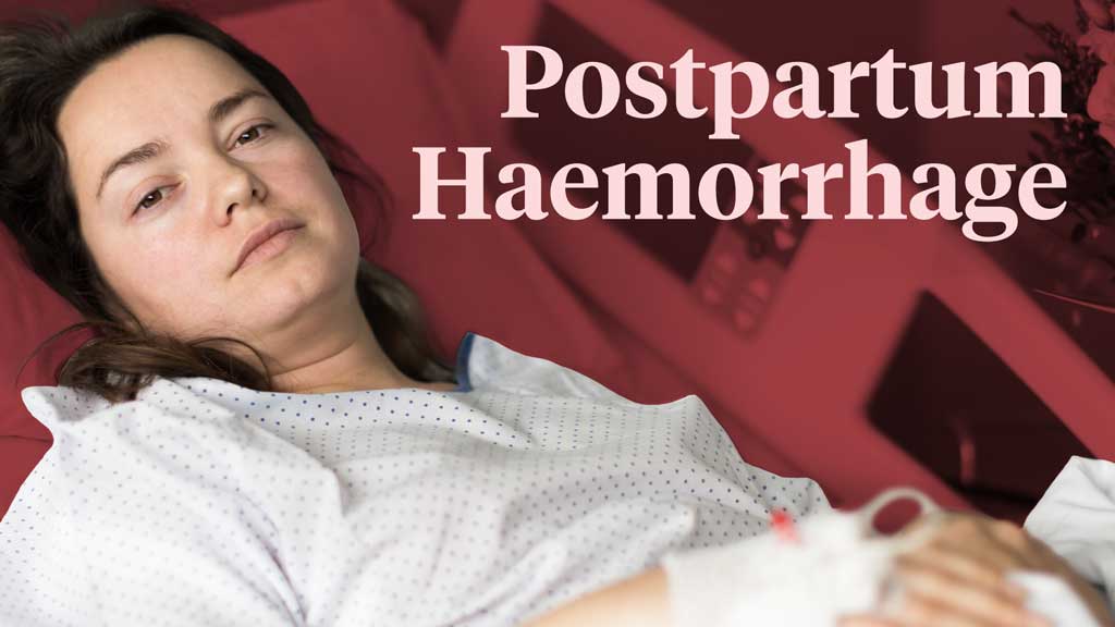 Image for Postpartum Haemorrhage and Fundal Massage