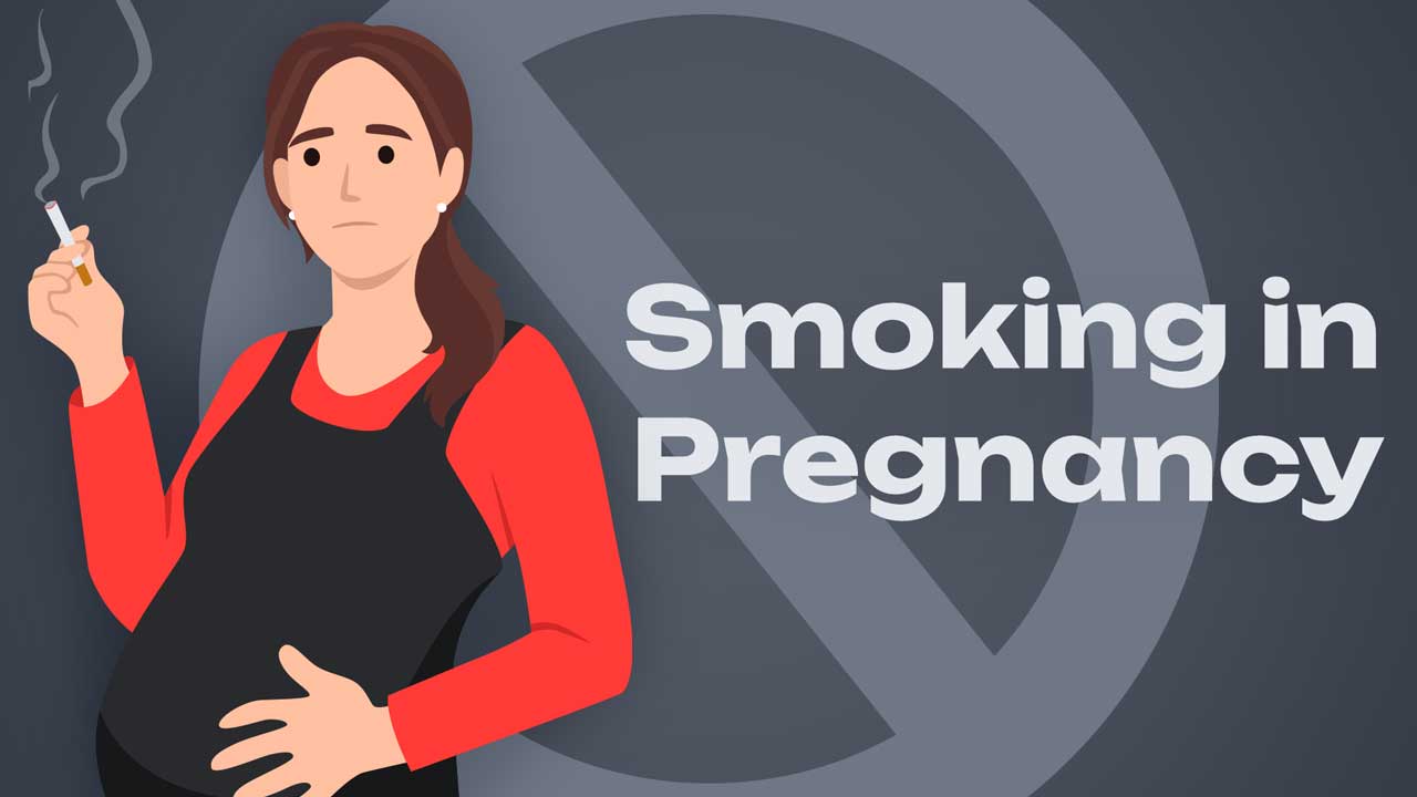 Cover image for: Smoking in Pregnancy: A Danger to Parent and Baby