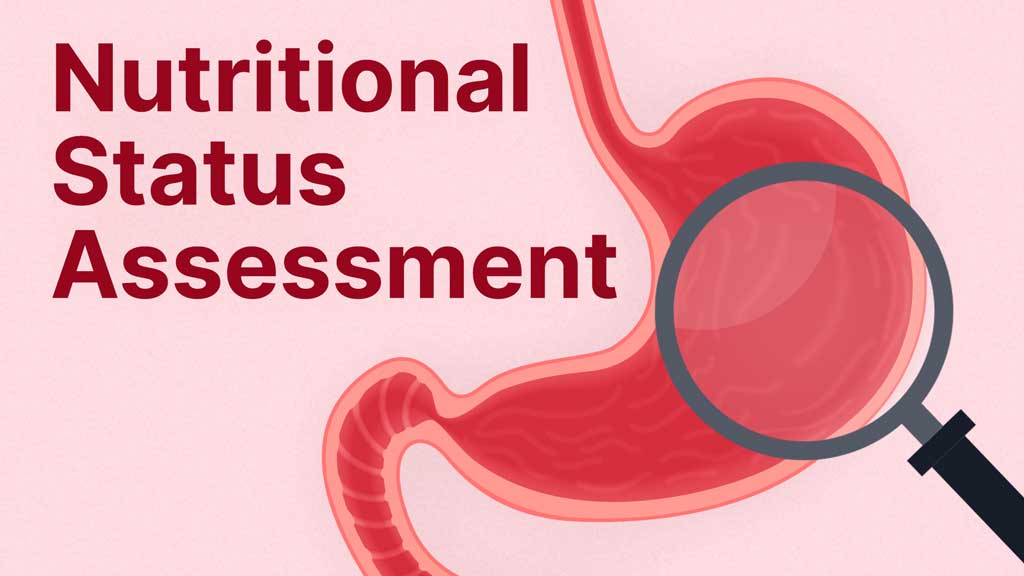 Image for Nutritional Status Assessment of the Critically Ill Patient