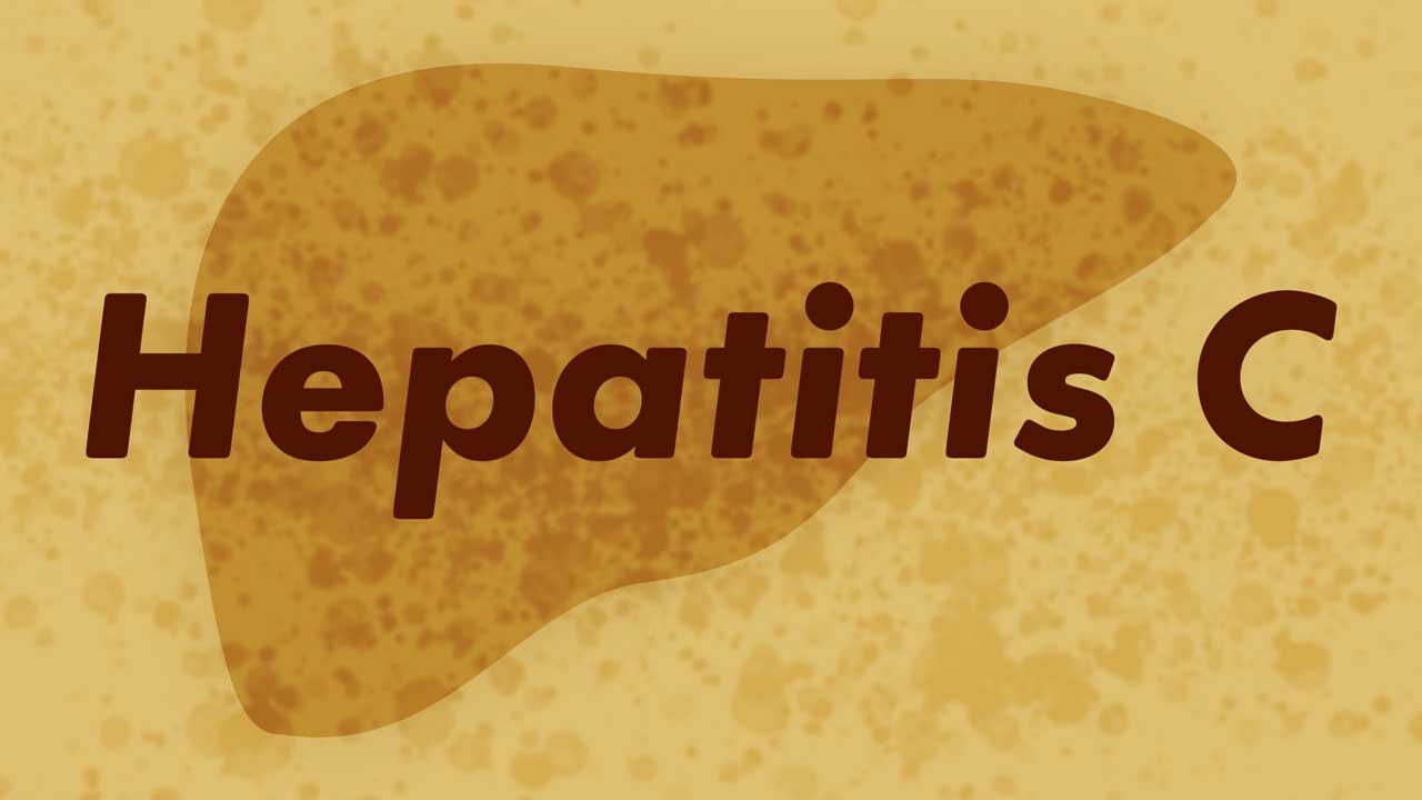 Image for Hepatitis C Virus (HCV)