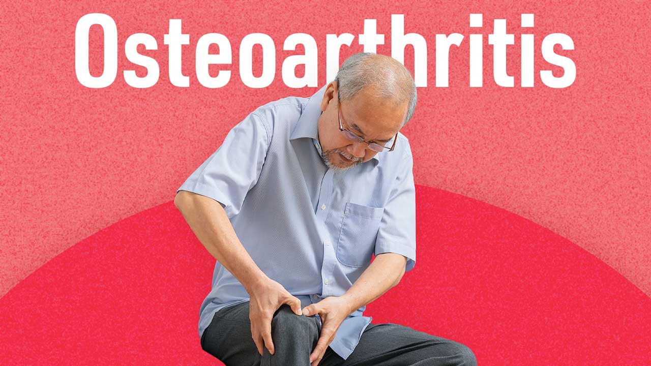 Image for Osteoarthritis Care and Management