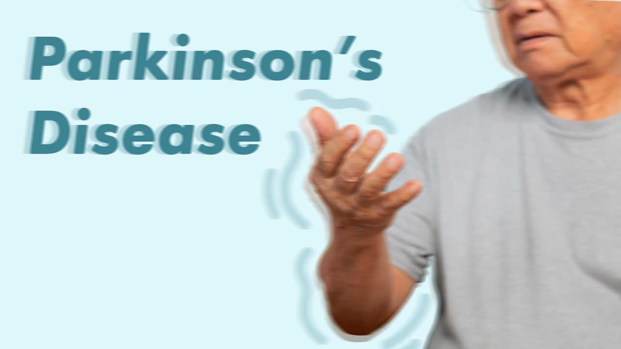 Cover image for: Parkinson's Disease