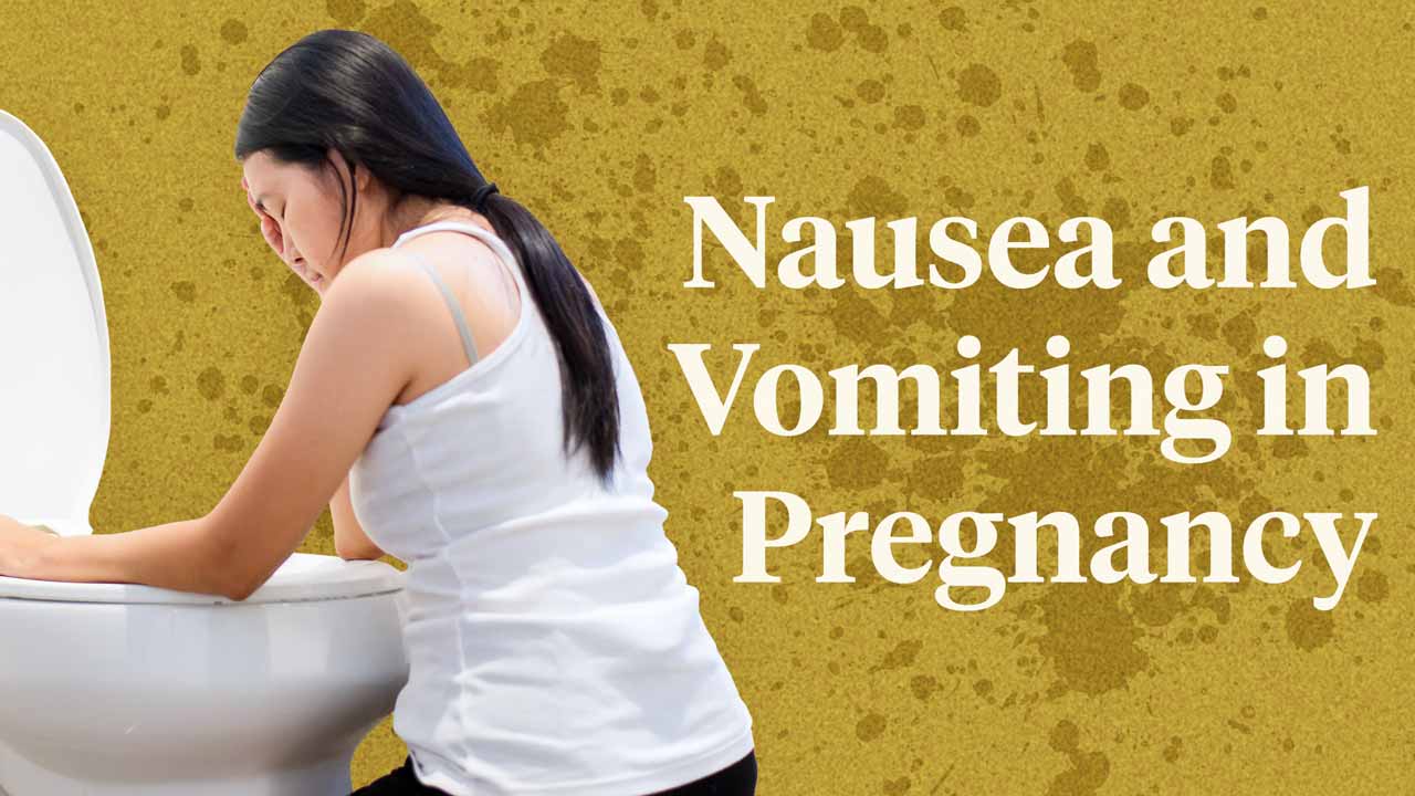 Cover image for: Nausea and Vomiting in Pregnancy (Morning Sickness)