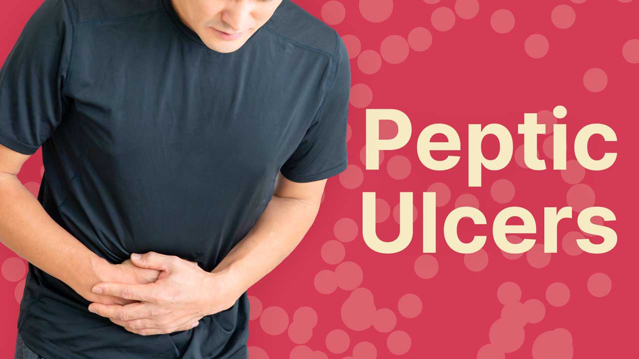 Image for Peptic Ulcers: Types, Symptoms and Treatment