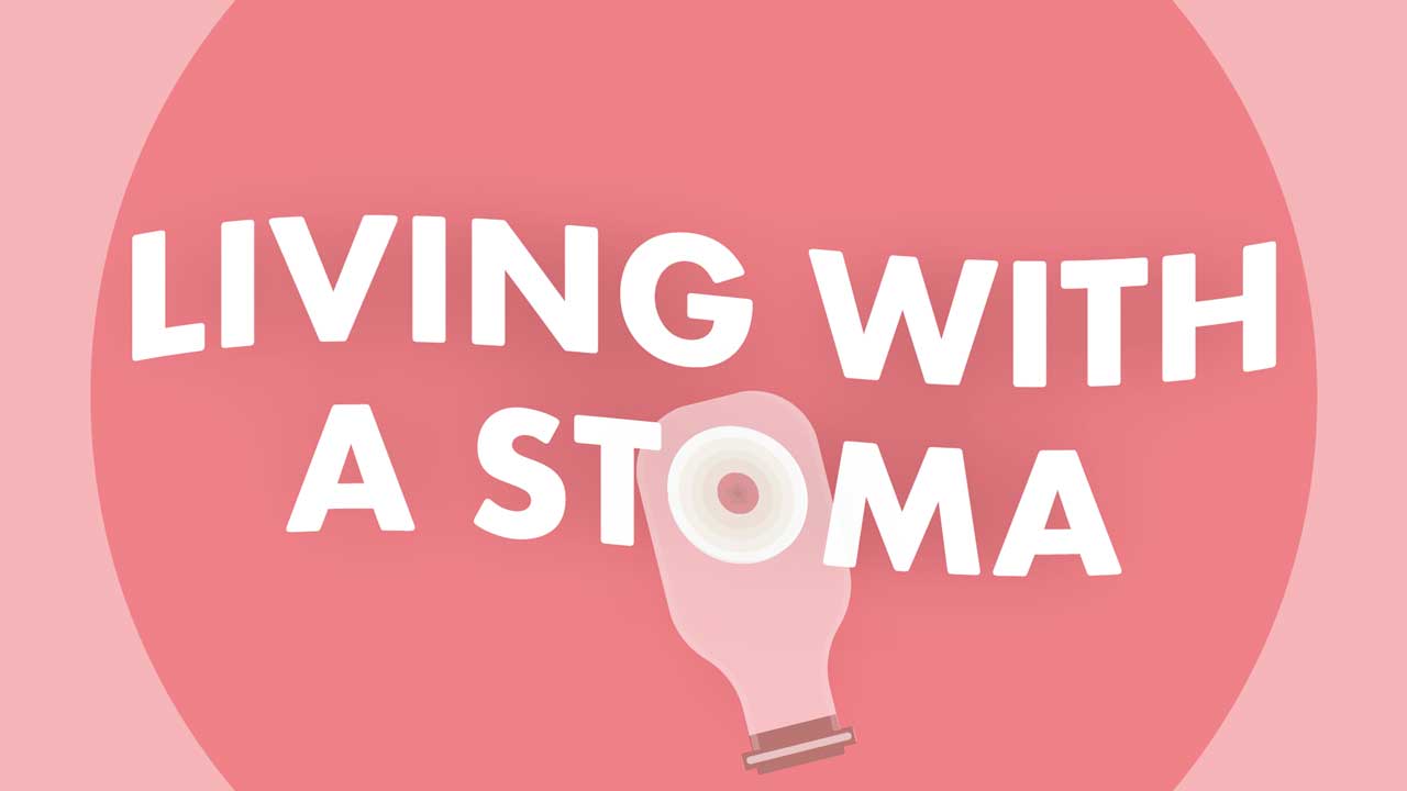 Image for Living Well With a Stoma