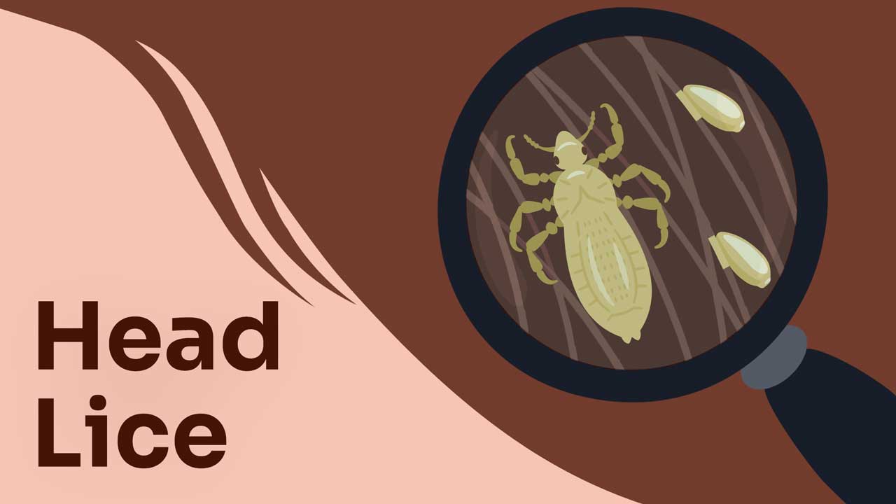 Head Lice: What They Are and How to Get Rid of Them | Ausmed