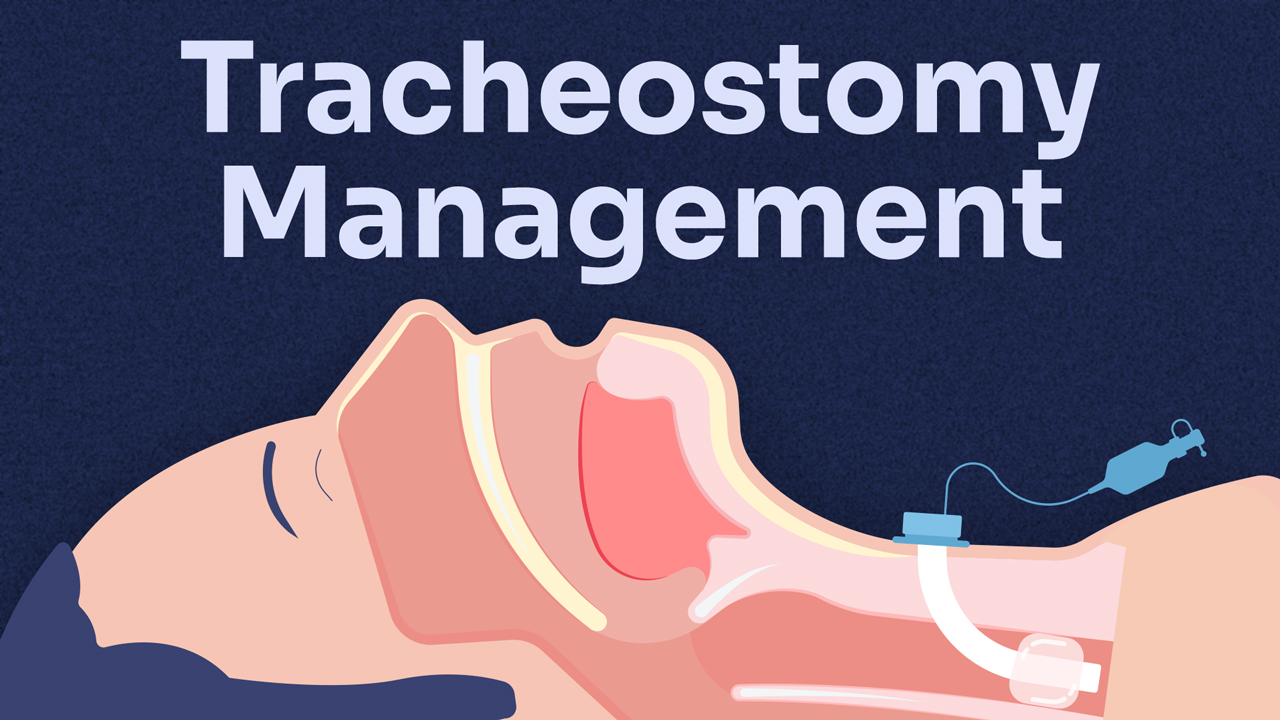 Image for Tracheostomy Management