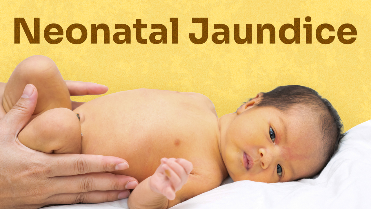 Image for Managing Neonatal Jaundice at Home