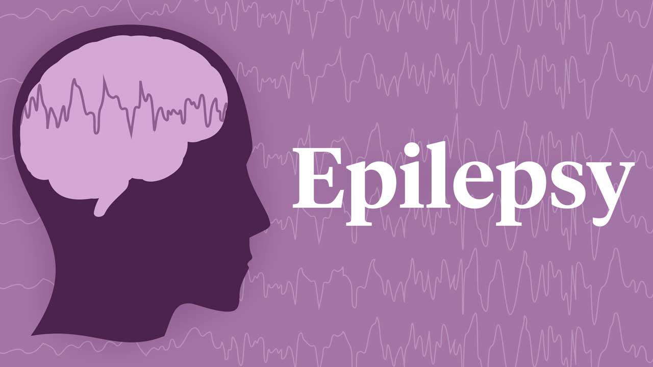 Image for Epilepsy Overview and Care