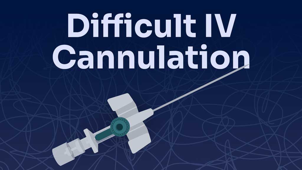 Image for Managing Difficult IV Cannulation