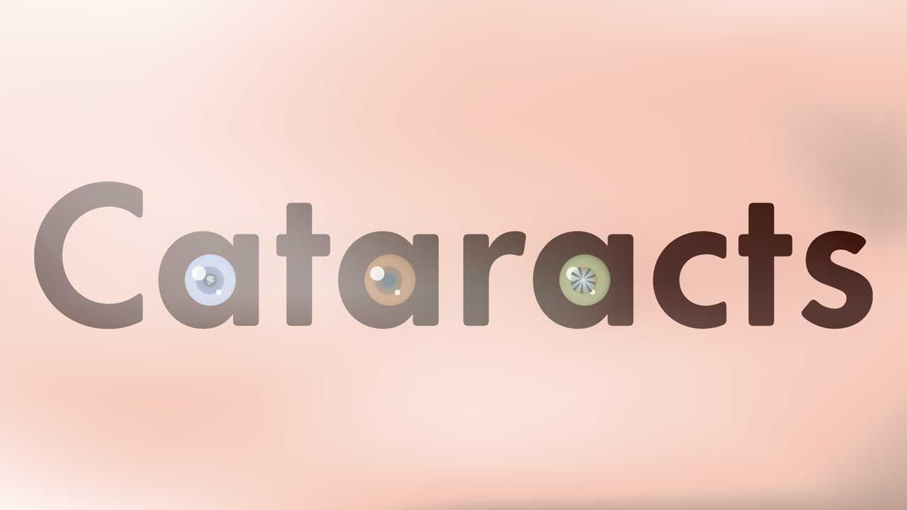 Image for Causes of Cataracts and Why They're so Common