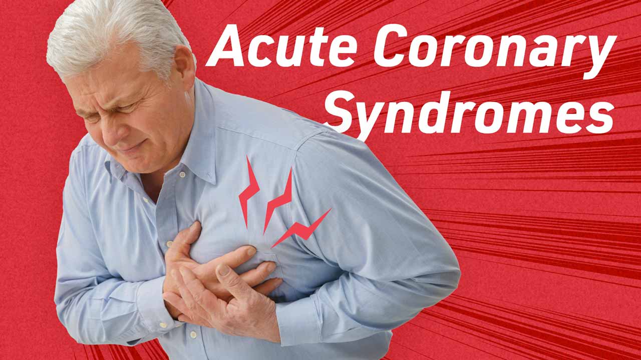 Image for Clinical Management of Acute Coronary Syndromes