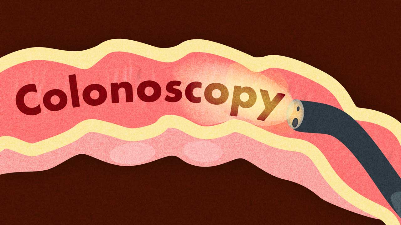 Image for Colonoscopy Procedures and Standards