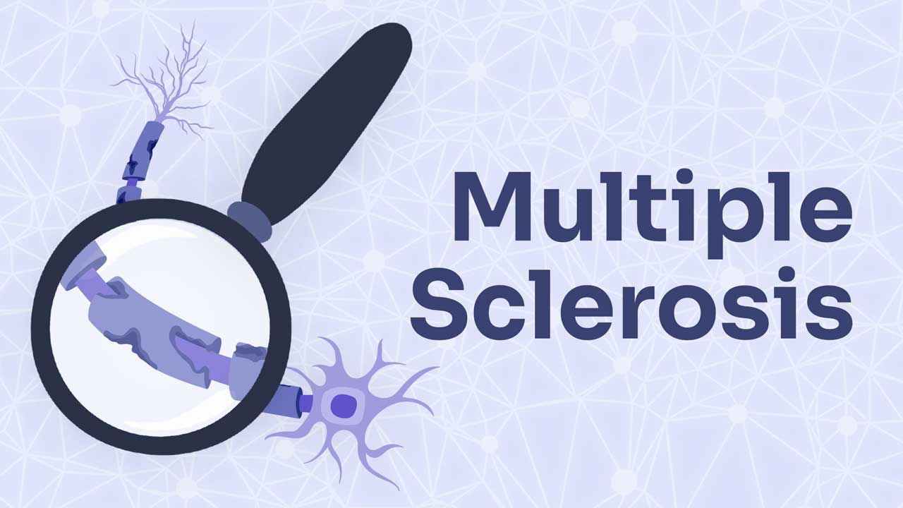 Image for How Does Multiple Sclerosis Affect the Body?