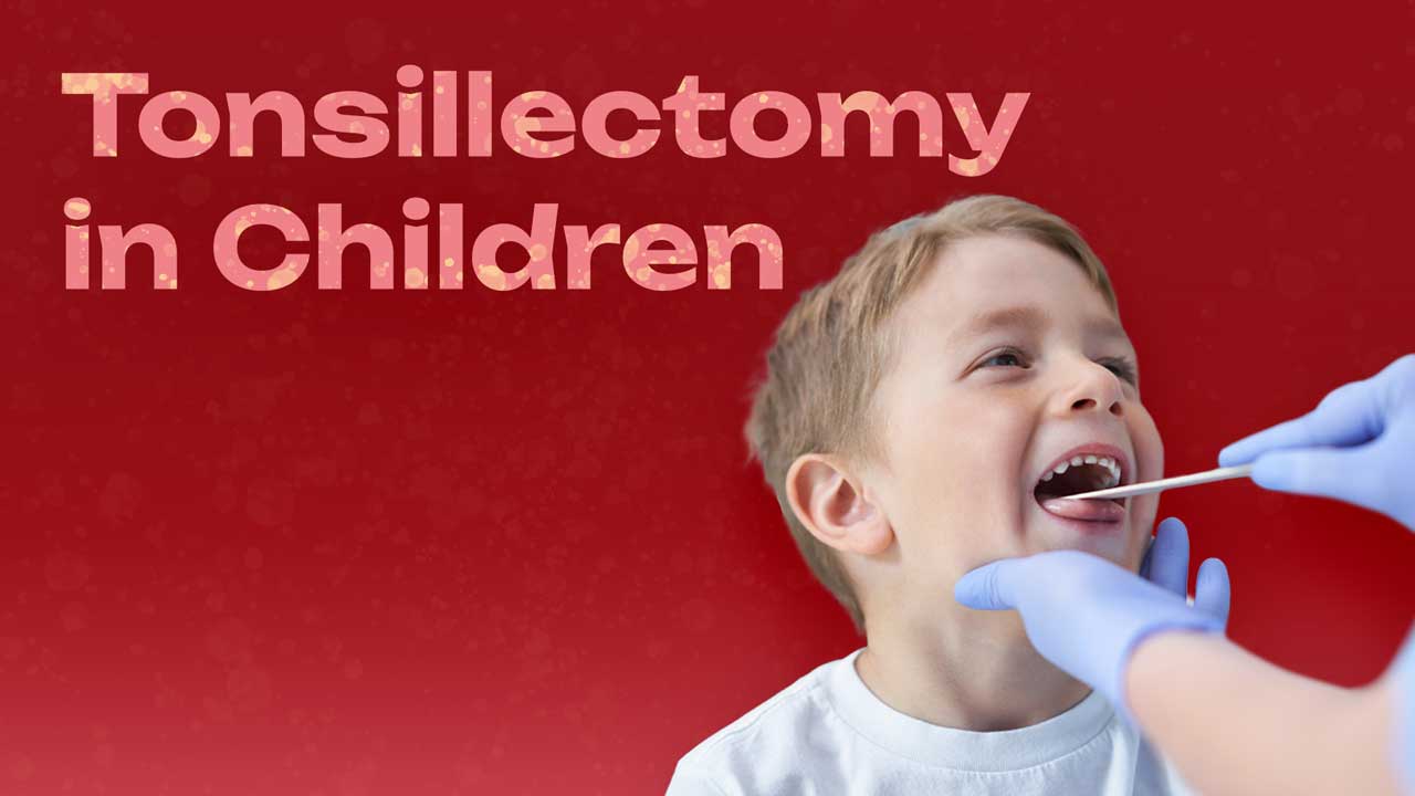 Cover image for: Tonsillectomy in Children: When is it Necessary?