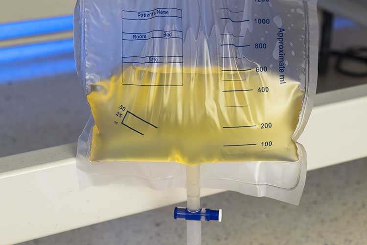 catheter care home urine drainage bag