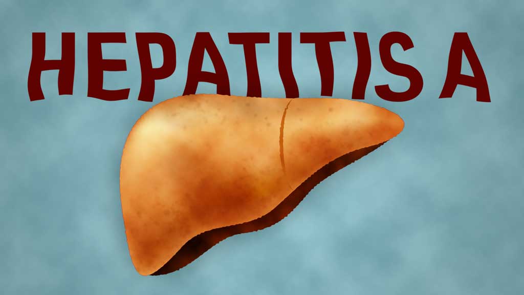 Image for Hepatitis A Virus (HAV)