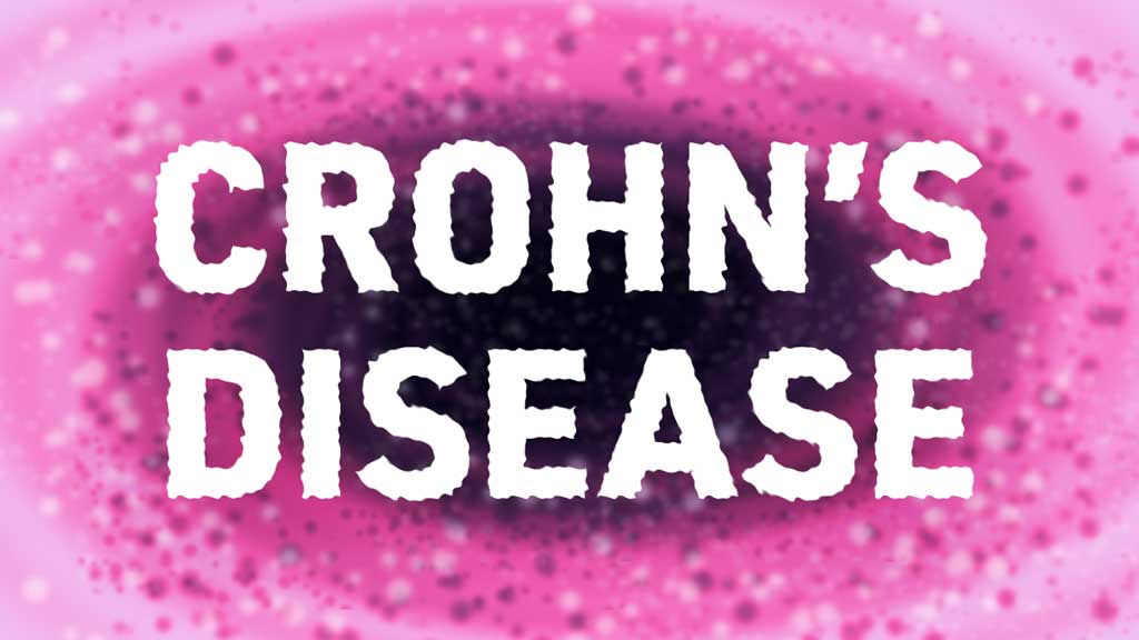 Image for Crohn's Disease