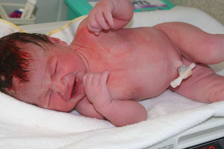 small gestational age baby being weighed