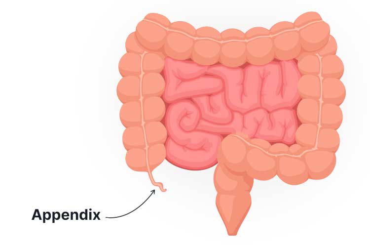 appendix diagram