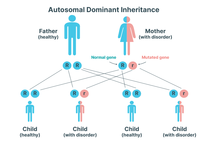 polycystic kidney disease autosomal doinant inheritance pattern