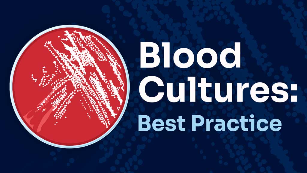 Image for Blood Cultures: Best-Practice