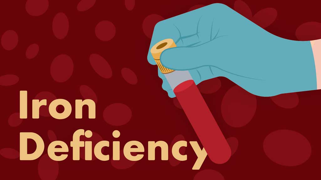 Image for Iron Deficiency