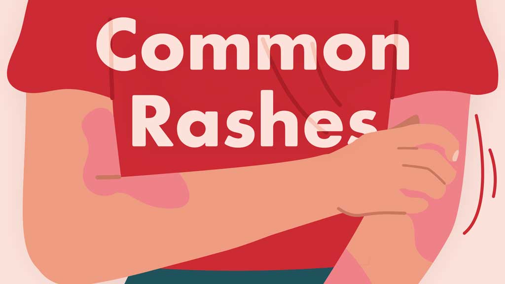 Image for Common Rashes: An Overview