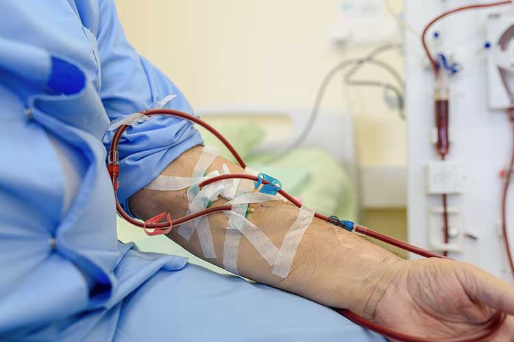 chronic kidney disease dialysis