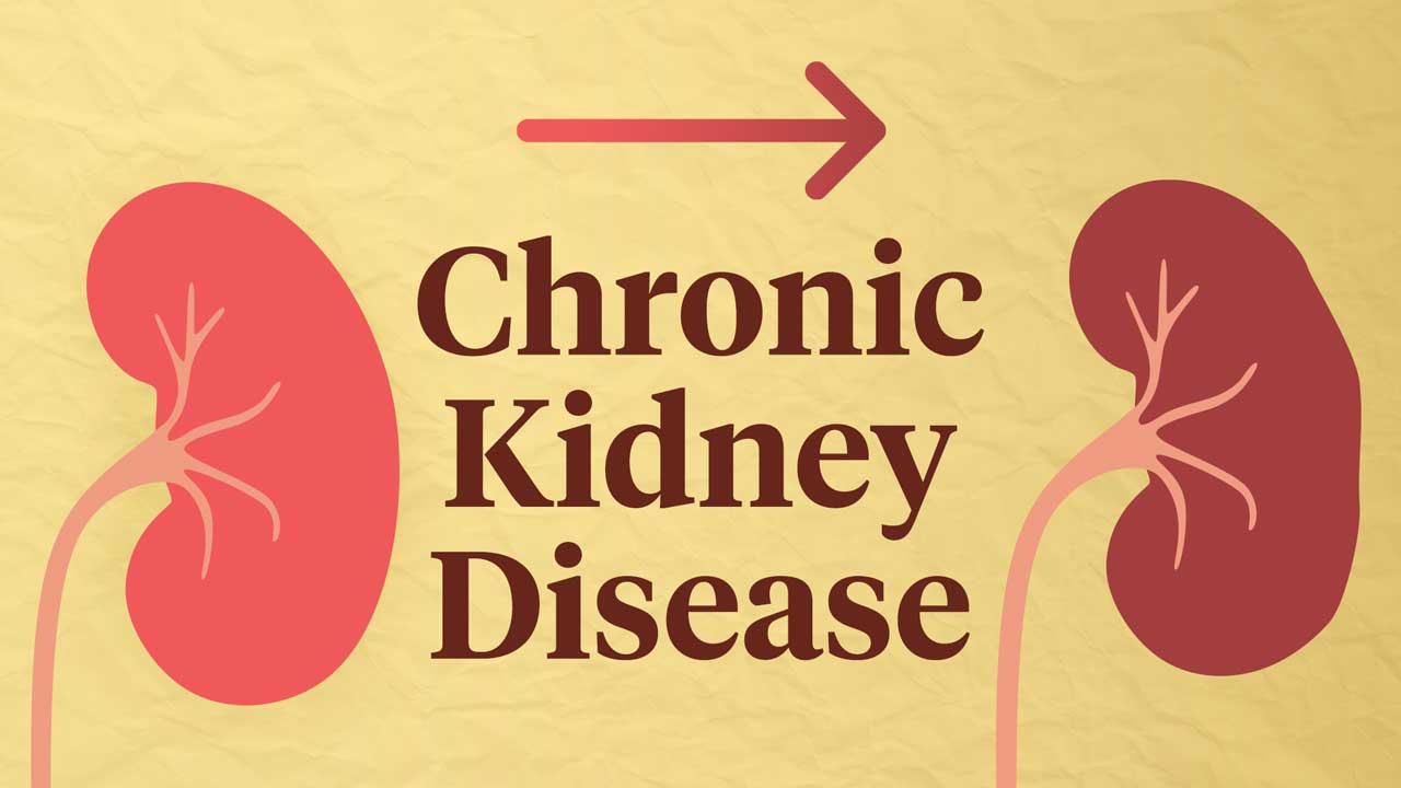 Image for Chronic Kidney Disease