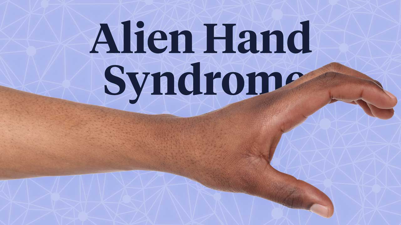 Image for Alien Hand Syndrome