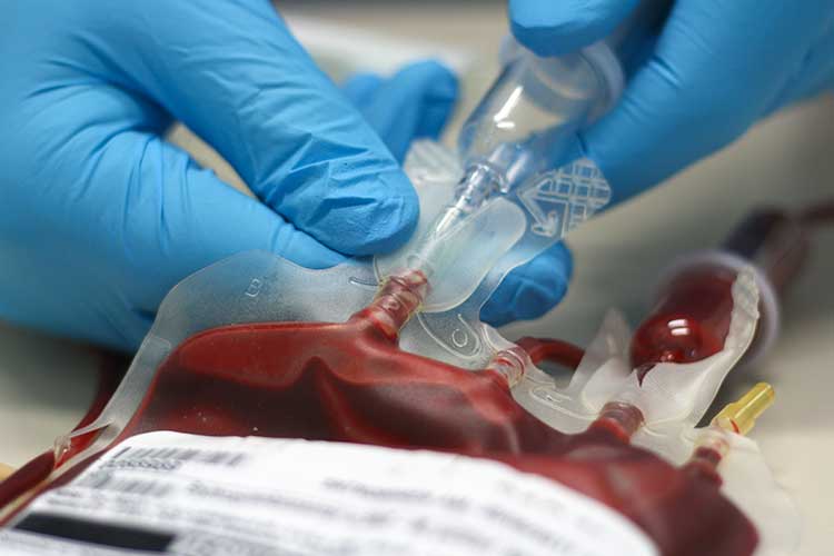 massive blood transfusion