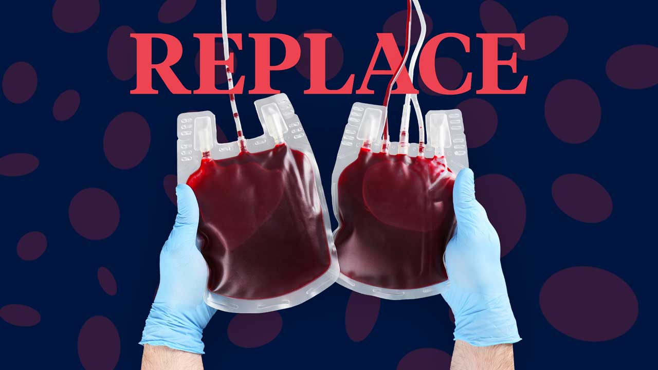 Image for REPLACE: Seven Steps to Remember During A Massive Blood Transfusion