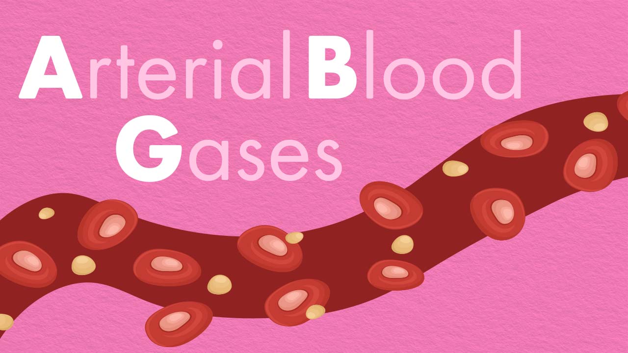 Cover image for: Arterial Blood Gases