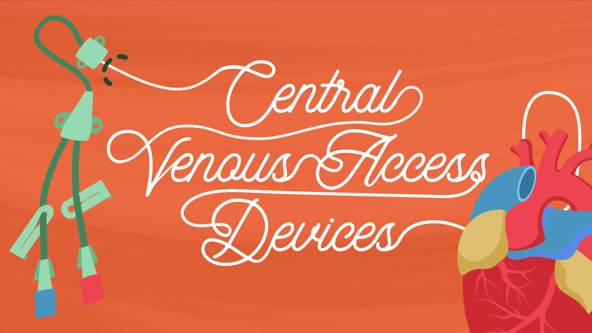 Cover image for: Central Venous Access Devices (CVADs)