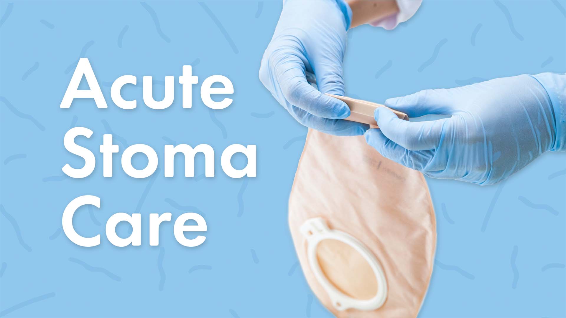 Cover image for: Acute Stoma Care