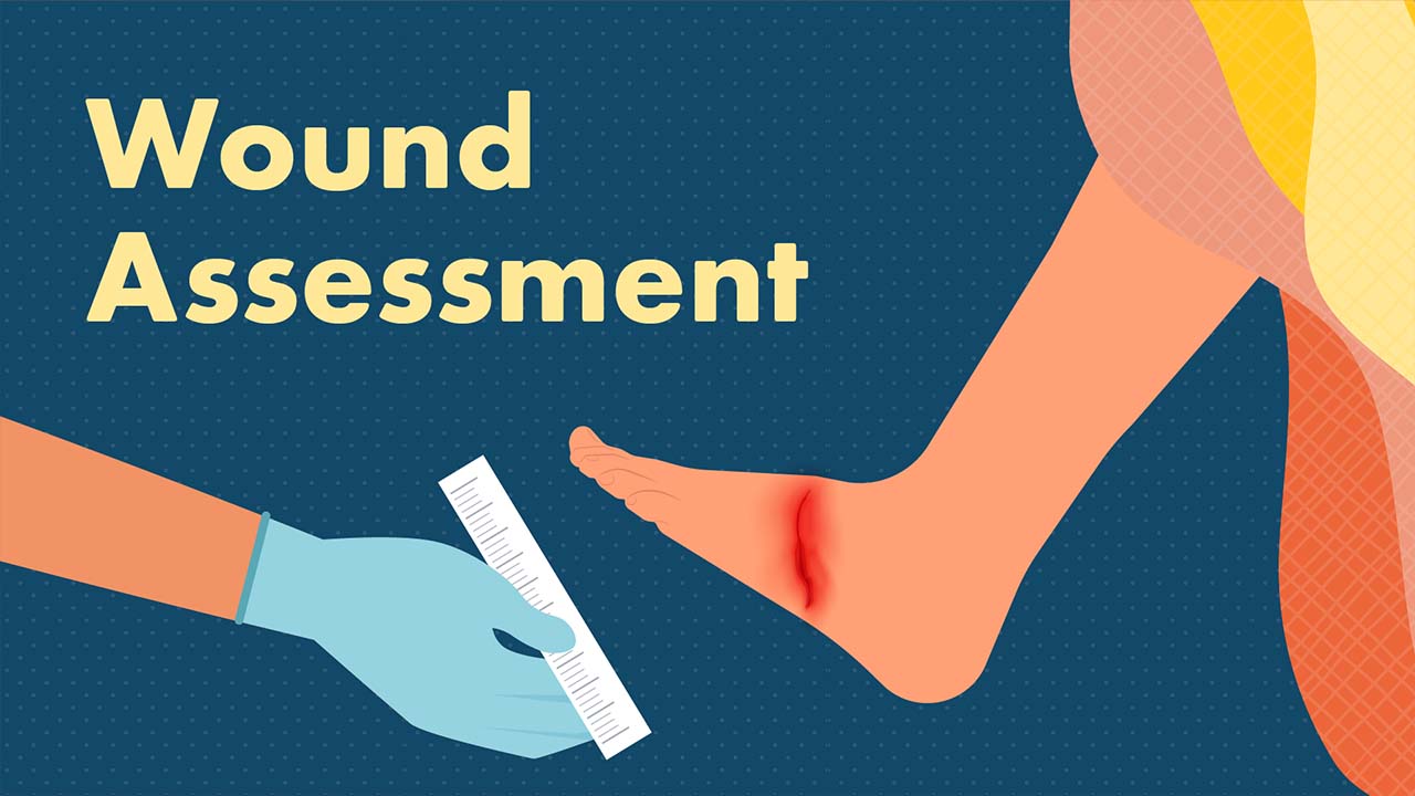 Cover image for: Wound Assessment