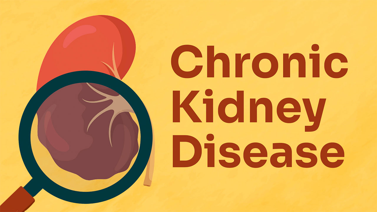 Image for Chronic Kidney Disease (CKD)