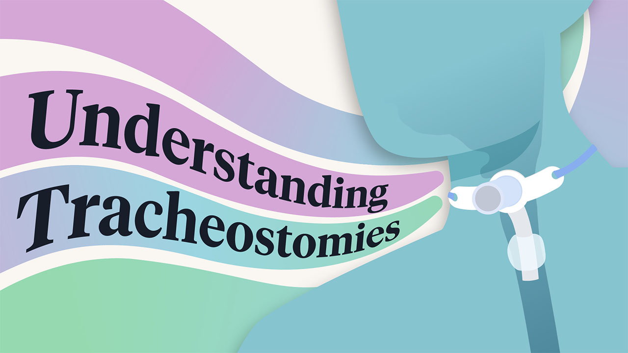 Image for Understanding Tracheostomies