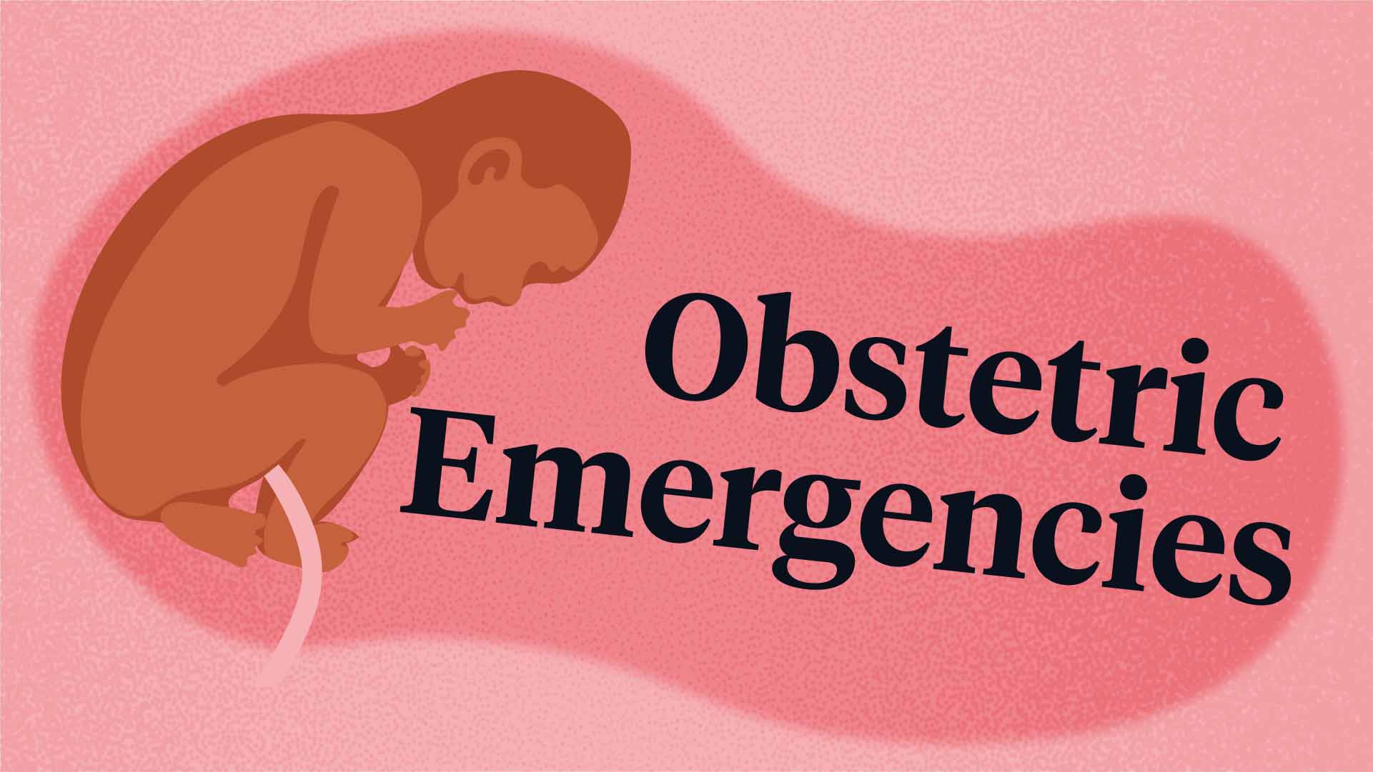 Cover image for: Obstetric Emergencies