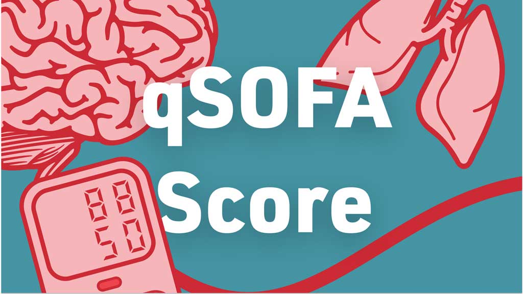 Image for qSOFA Score (Quick Sepsis-Related Organ Failure Assessment)