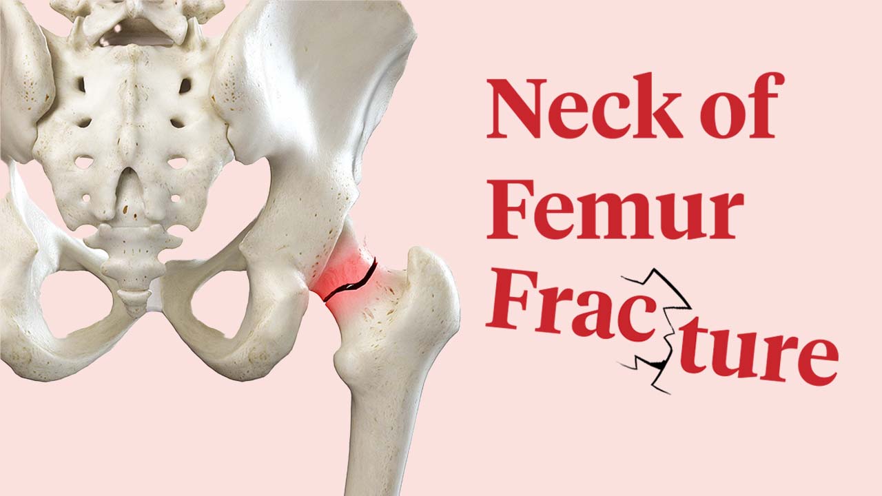 Image for Neck of Femur Fracture