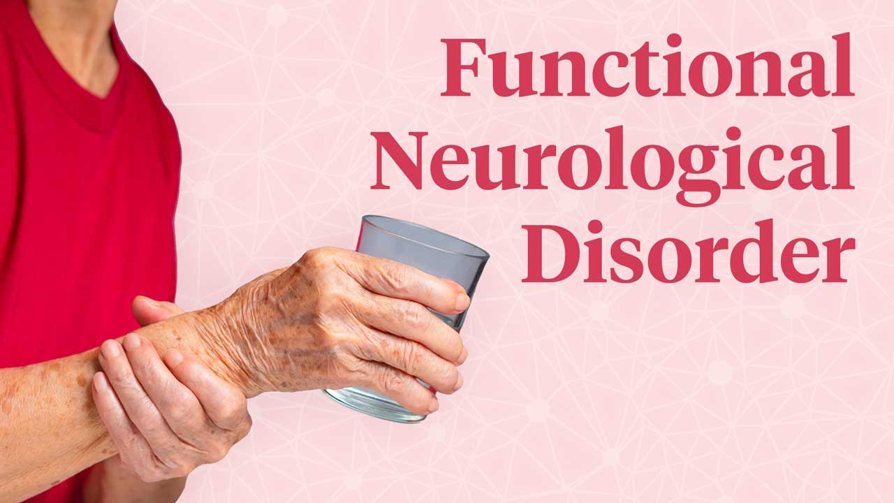 Cover image for: Functional Neurological Disorders: Case Studies